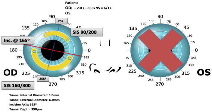 FIGURE 4