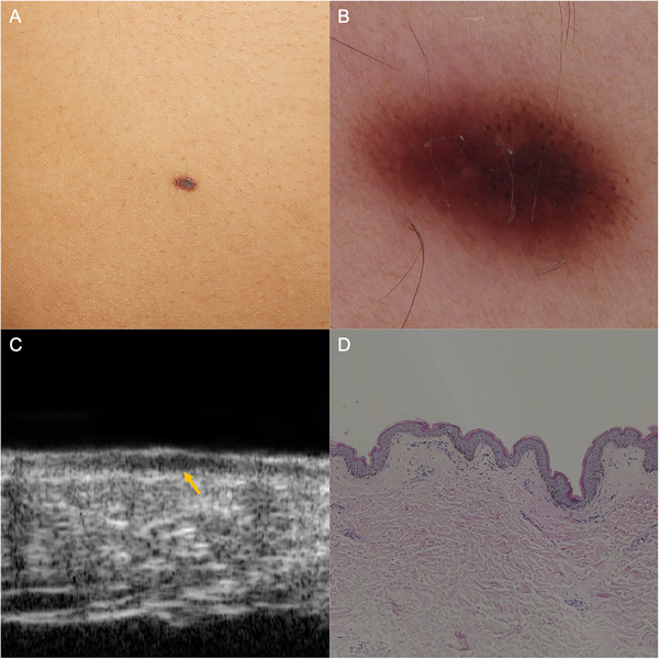 FIGURE 2