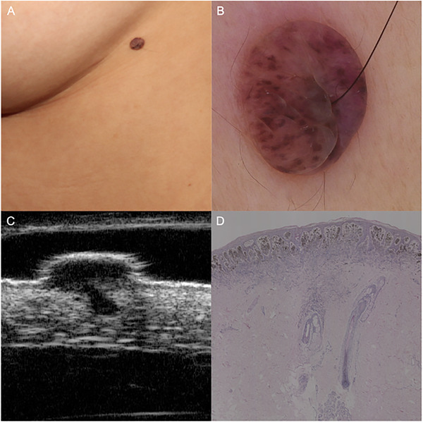 FIGURE 4