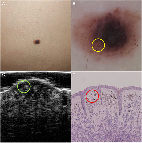 FIGURE 5