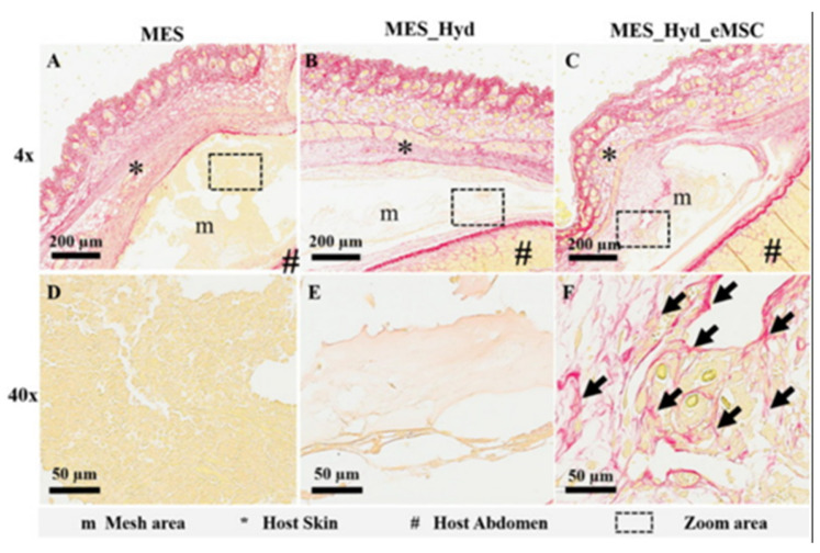 Figure 11