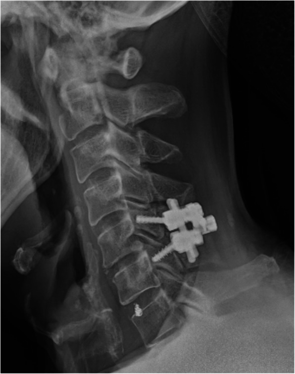Fig. 4