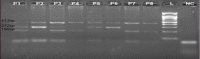 Figure 1A