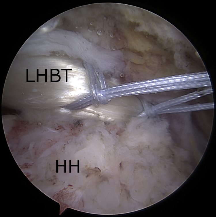 Fig 3