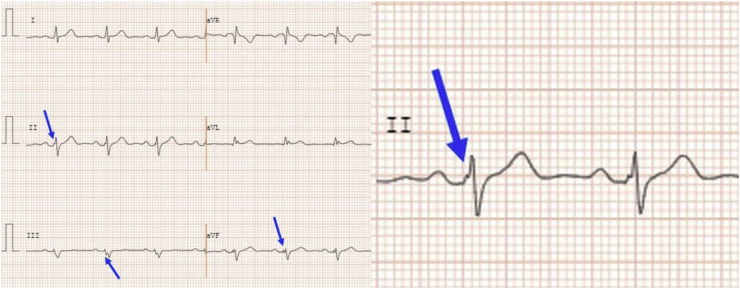 Fig. 1