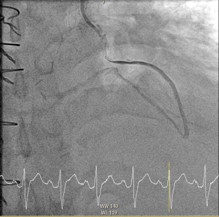 Figure 3