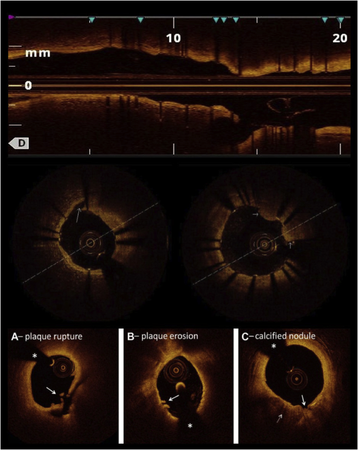 Fig. 4