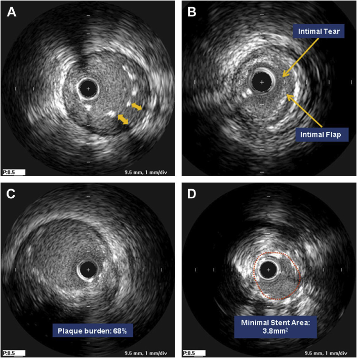 Fig. 2