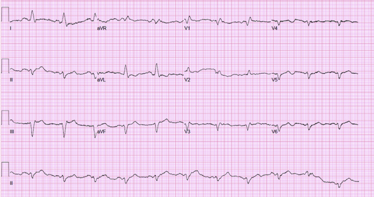 Figure 2