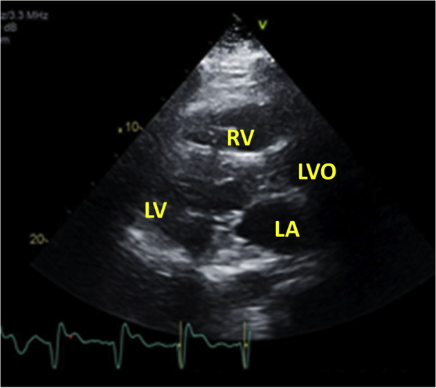 Figure 4