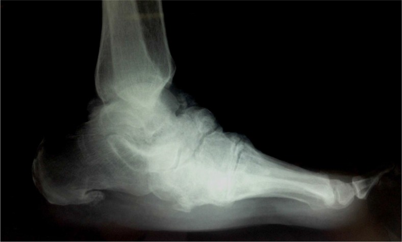 Fig. 1