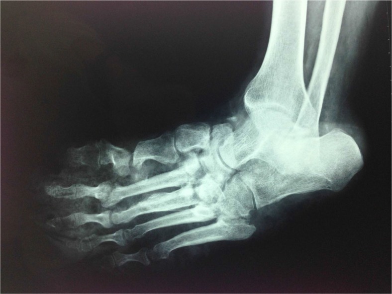 Fig. 2