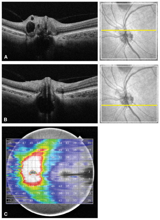 FIG. 4