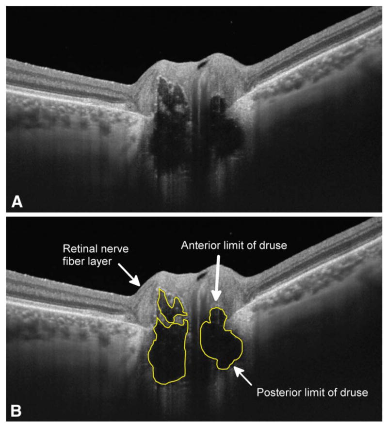 FIG. 3