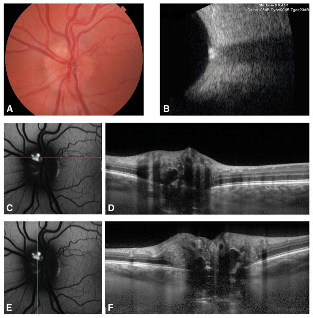 FIG. 1