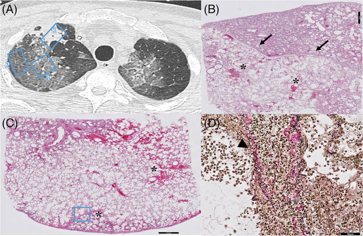 FIGURE 3