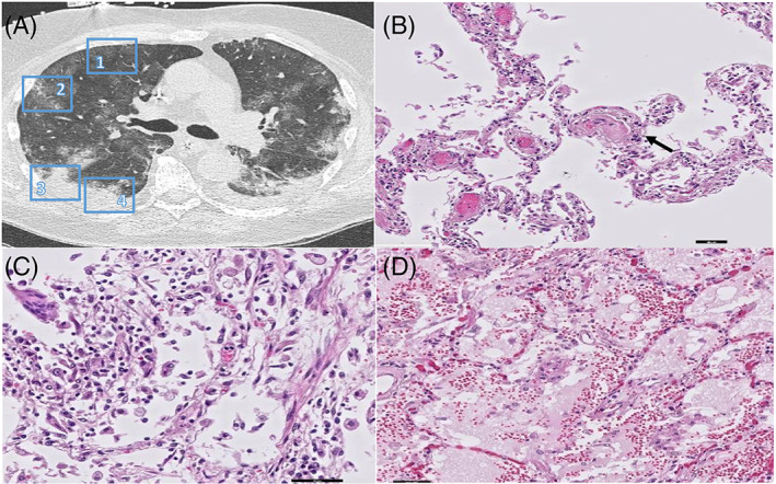 FIGURE 2