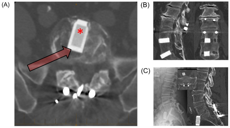 Figure 11