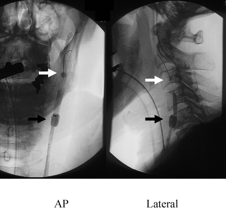 Fig 2.