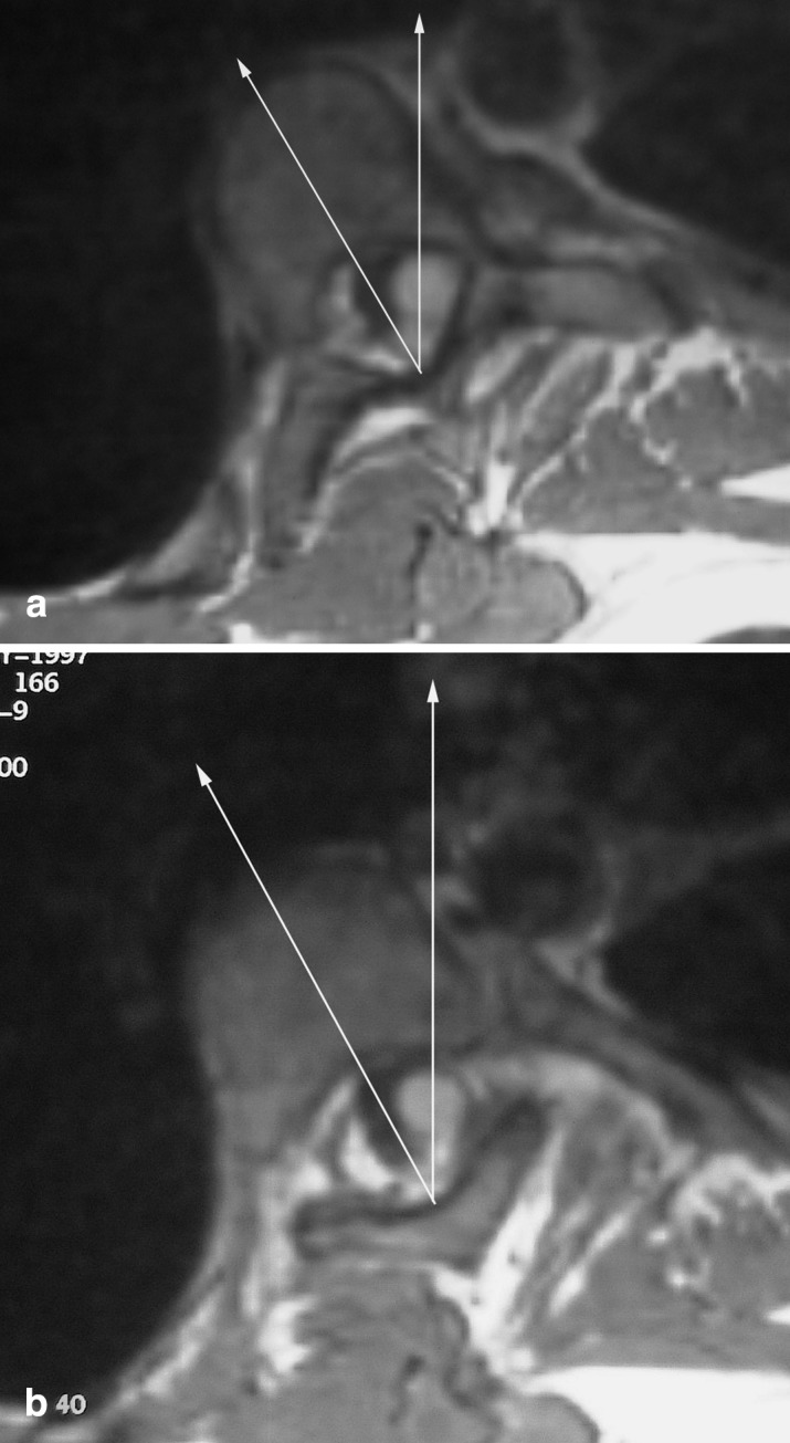 Fig. 2 a