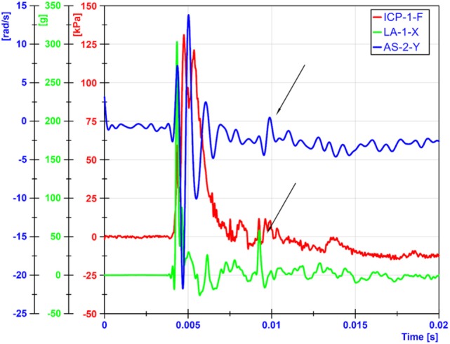 Figure 12