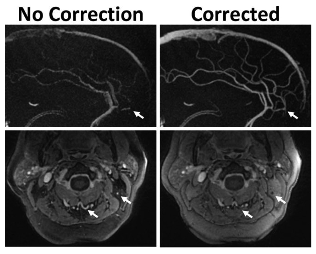 FIG. 1