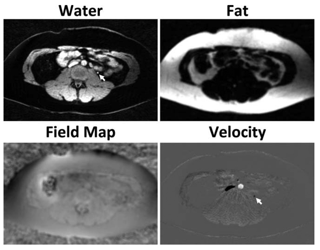 FIG. 9