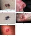 Fig. 3