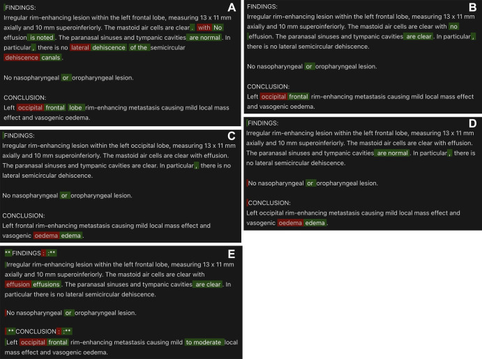 Model output comparison for a sample generated radiology report with multiple errors. Errors (red) and corrections (green) detected by (A) GPT-4, (B) text-davinci-003, (C) GPT-3.5-turbo, (D) Llama-v2–70B-chat, and (E) Bard.