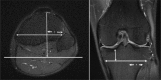 Fig, 2