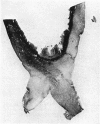 332-2
