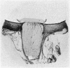 332-1