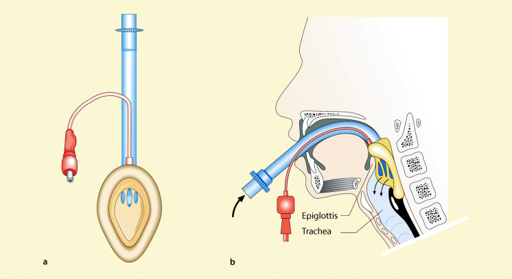 graphic file with name 6376_9_De_8_Fig26_HTML.jpg