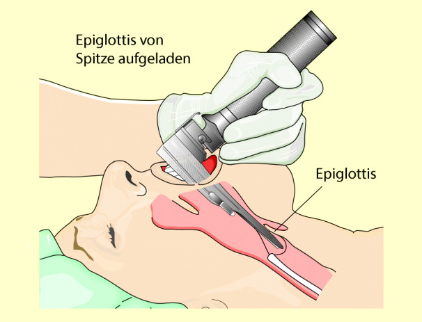 graphic file with name 6376_9_De_8_Fig10_HTML.jpg