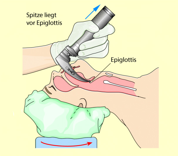 graphic file with name 6376_9_De_8_Fig9_HTML.jpg
