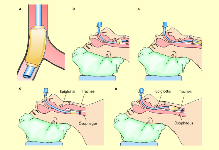 graphic file with name 6376_9_De_8_Fig25_HTML.jpg