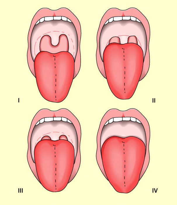 graphic file with name 6376_9_De_8_Fig6_HTML.jpg