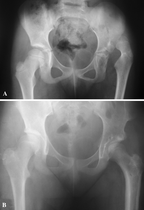 Fig. 1A–B