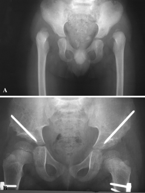 Fig. 3A–B