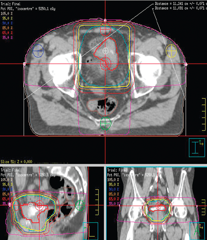 Fig.1