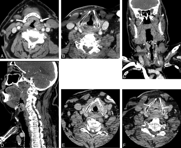 Fig 2.