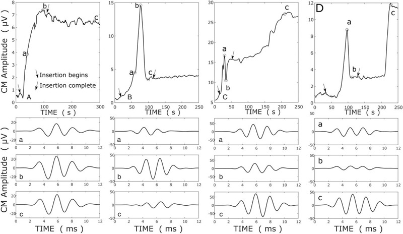 FIG. 1