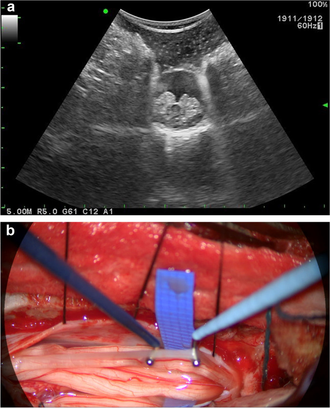 Fig. 1