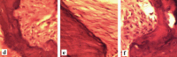 [Table/Fig-6d-f]: