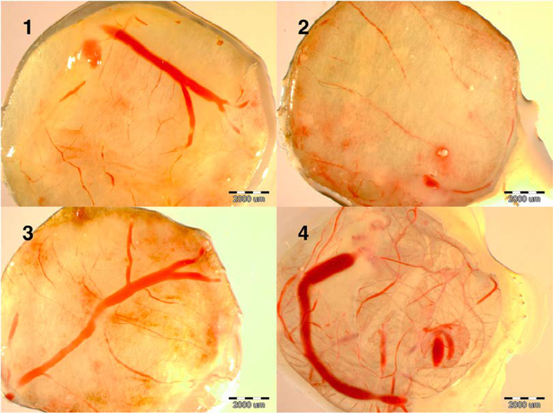 Fig. 15