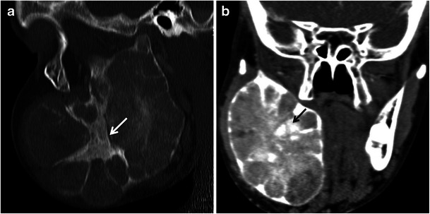 Fig. 10