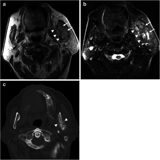 Fig. 12