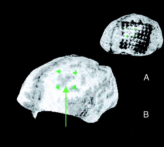 Fig 2.