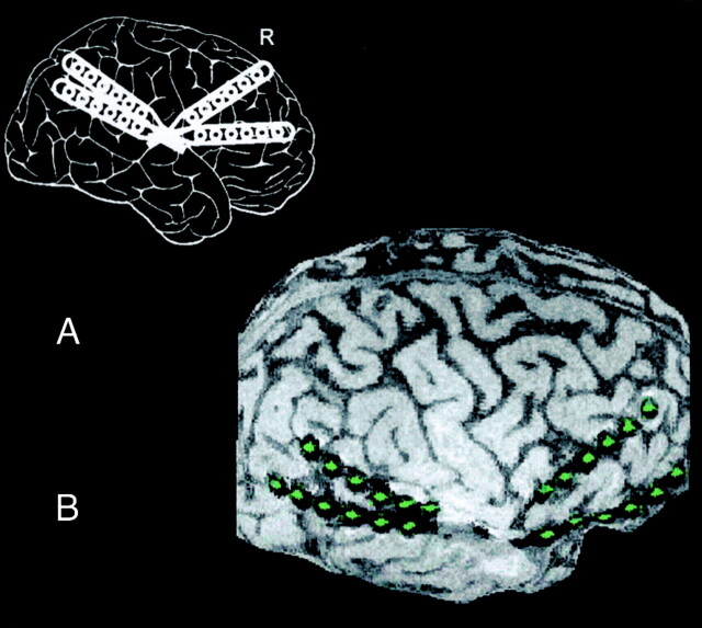 Fig 1.