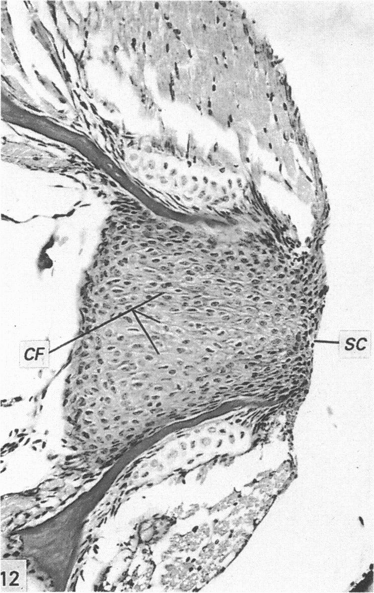 Fig. 12